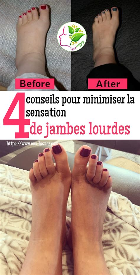 4 conseils pour minimiser la sensation de jambes lourdes en 2020 ...