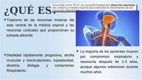 Las principales complicaciones son respiratorias y nutricionales. Esclerosis lateral amiotrofica - Docsity