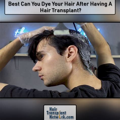 For instance, darker hair takes longer to lighten. Best Can You Dye Your Hair After Having A Hair Transplant?