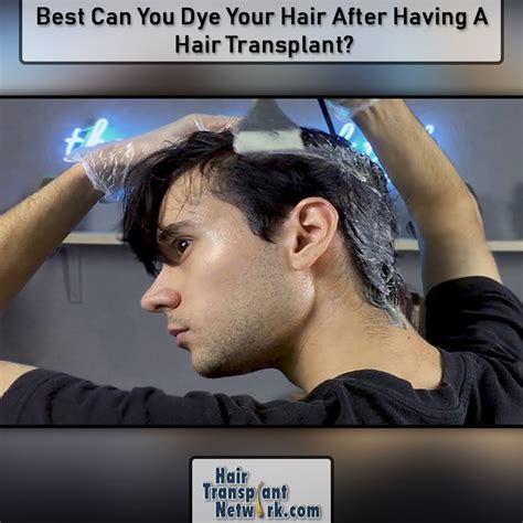If you want to dye your hair while pregnant, it's probably best to wait until after the first trimester. Best Can You Dye Your Hair After Having A Hair Transplant?