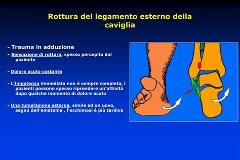 PPT - Traumatologia della caviglia PowerPoint Presentation ...