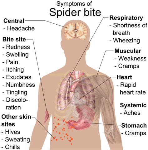 If a poisonous spider bites you, additional symptoms may include: How to Identify Spider Bites | Triangle Pest Control