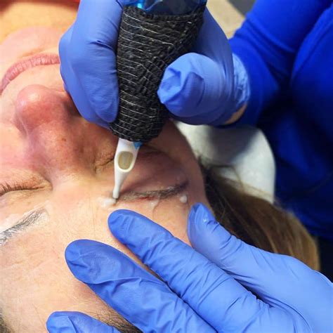 We did not find results for: Why Choose UNDO Tattoo Removal? | UNDO Removal