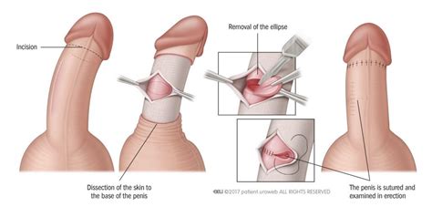 We did not find results for: Νόσος Peyronie - Τι είναι & πως αντιμετωπίζεται; Χρήστος ...