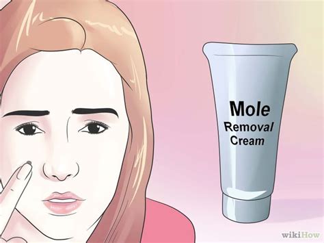 Ohne behandlung kann es sich ausbreiten und eine lebensbedrohliche infektion verursachen. Einen Leberfleck zu Hause behandeln | Mole removal cream ...