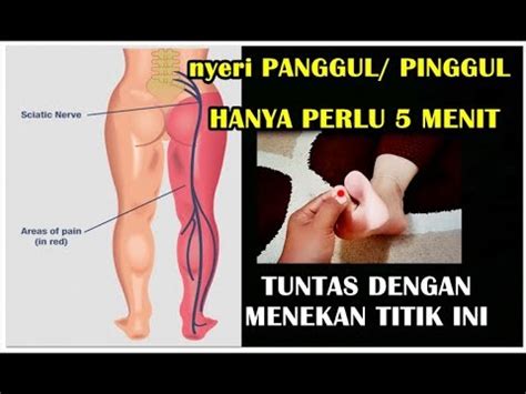 Sakit pinggang kiri hingga ke paha. Nyeri Pada Tulang Dan Sendi Paha | 03 Nyeri Tulang