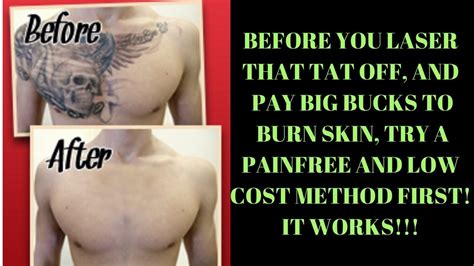 While tattoos are generally considered permanent, it is now possible to remove them with treatments, fully or partially. Dr. Tattoff - Crazy Video of Man Getting Face Tattoo ...