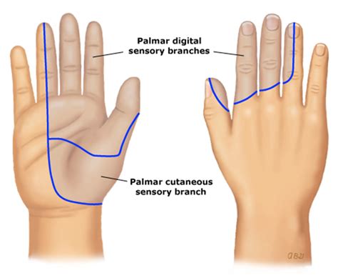 It can detrimentally impact the use of the entire arm, as well as the shoulder. Eastside Family Health Center: Carpal Tunnel Syndrome