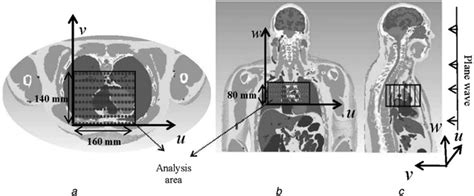 Detects changes in internal and external environment. Simulation model of the human torso a Top view b Front view c Side view | Download Scientific ...