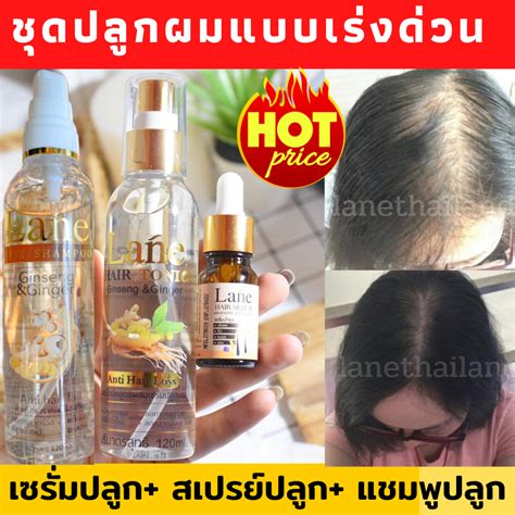 Try our dedicated shopping liquid liquid spray lotion mousse multiple forms oil pomade putty scrub serum spray texturizer black. ซื้อที่ไหน J-Hair Serum ยาปลูกผม 3ขวด!!! | Zara Beauty Review