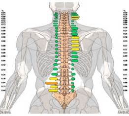 The area of back between ribs and buttocks. Gohl Clinic of Chiropractic in Carlsbad - Severe Low Back Pain