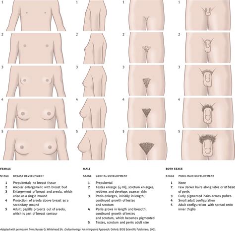 Further enlargement of breast tissue and areola, with no separation of their contours. Hypothalamus and pituitary gland | Obgyn Key