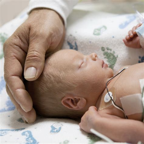 1 x trustworthy source mayo clinic educational website from one of the world's leading. Premature Babies | BabyCenter