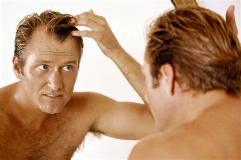 How to stop receding hairline at temples. How to Stop A Receding Hair Line | Hair Transplant NYC ...