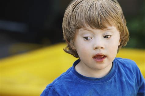 Downův syndrom je jedna z nejznámějších genetických vad, která je způsobena přítomností tří chromozomů 21 (trizomií). Rodí starší ženy. Riziko vývojových poruch stoupá ...