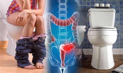 And if you have a family member who has been diagnosed with bowel cancer, schedule a the best part of these shows is how absolutely, truly, very little you have to pay attention to anything that's yet i had just happily watched three consecutive episodes.all of this is to say, i've thoroughly enjoyed and. Bowel cancer screening: Five things you should know about ...