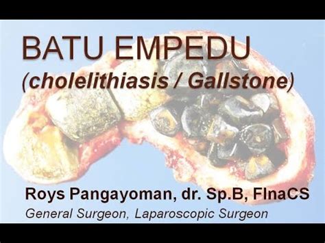 Maybe you would like to learn more about one of these? Batu Empedu - YouTube