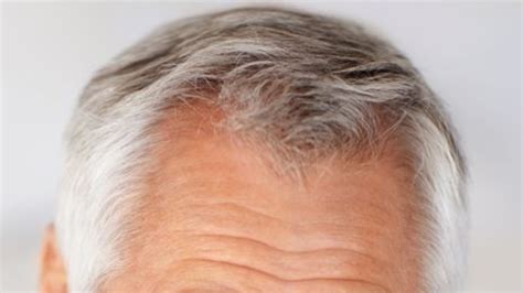 Stress can definitely trigger a higher rate of hair loss, though, so if you're no spring chicken and your hair follicles are producing less pigment, chances are the new strands that. Stress can turn hair grey and it might be reversible, new ...