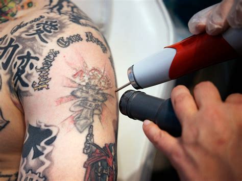 Here are four factors that determine the length of your tattoo removal session dark tattoos tend to absorb more heat, which causes extra swelling and blistering. How Long Does It Take For A Tattoo To Fade After Laser Treatment