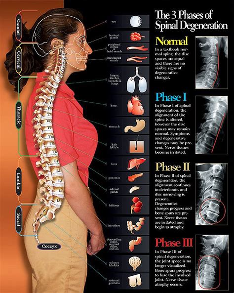 Sports chiropractic care in eden prairie, mn. Pin on Chiropractic