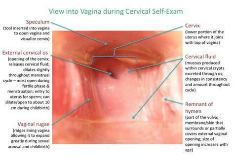 Sexual fluidity is one or more changes in sexuality or sexual identity (sometimes known as sexual orientation identity). Medical and Health Science: Cervical Self Exam!!!