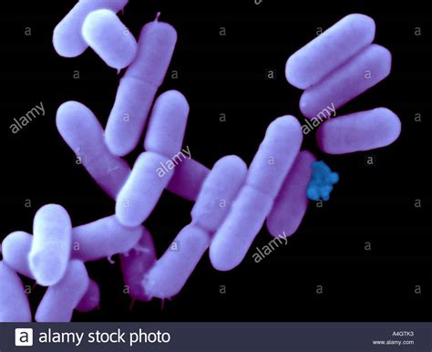 Patients with cancer, particularly those of blood, are also at high risk for listeria infection. A false coloured scanning electron micrograph of Listeria ...