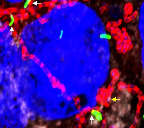 Listeria monocytogenes is a type of bacteria that can cause food poisoning. Bioengineered probiotic could prevent Listeria infections ...