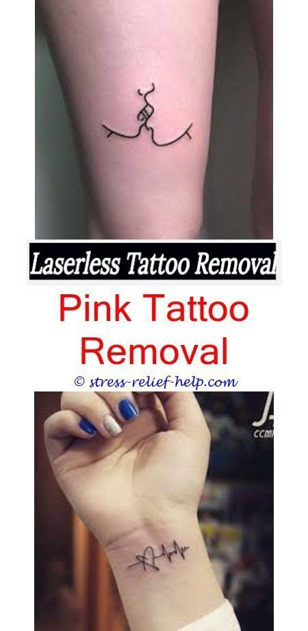 You should also be checking the laser technician who will be treating you has the adequate qualifications to be practising laser tattoo removal safely. erase tattoo removal is it safe to have a tattoo removed ...