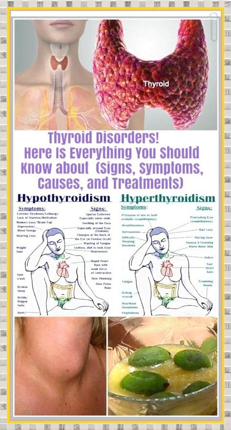 There has to be some sort of mechanism that regulates very. Here Is Everything You Should Know About Thyroid Disorders ...