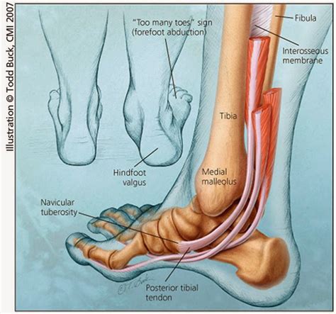 Hand bone and tendon chart. 尼西健康小學堂: 跑者不可不知的秘密～如何誘發美麗的足弓？