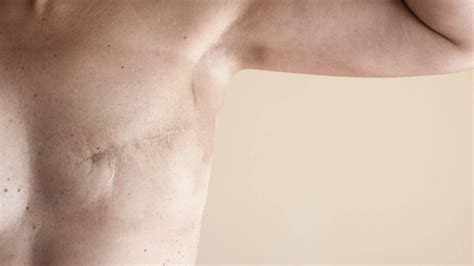 Here's are 10 signs to look out for that could indicate breast cancer. Underarm Pain Causes - Left, Right, Breast, & Sharp ...