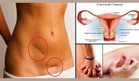 Anyone who experiences persistent or worrisome symptoms should consult a doctor. 10 Warning Signs of Cervical Cancer You Should Not Ignore