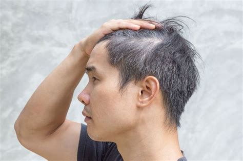 Halo guysapa sih penyebab rambut berubah putih atau uban, bahaya gak sih kalau uban atau rambut putih muncul di usia muda, ada beberapa sebab yuk simak full. Masih Muda Tapi Rambut Sudah Putih? Jangan Panik, Ini Hal ...