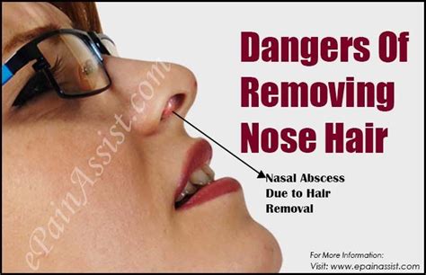 Discover what happens when using electrolysis for nose hair removal from an experienced h. Dangers Of Removing Nose Hair | Nose hair removal, Nose ...