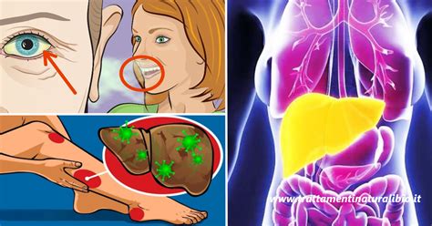9 segnali che indicano che il tuo fegato è pieno di tossine