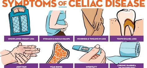 • decrease of main and parietal cells. Celiac Disease | Vita Pharmed SA. Switzerland