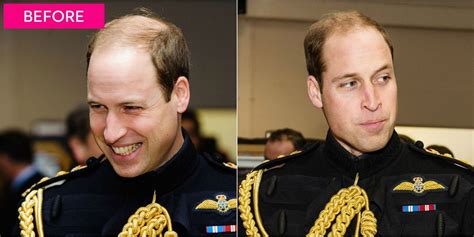 Everyone is buzzing about prince william's new haircut. Prince William Gets Super Short Haircut — Prince William's ...