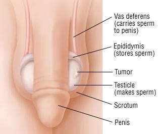 Check out these fierce natural hair ladies. Preventing Testicular Atrophy And/or Testicular ...