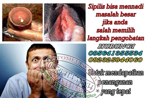 Gejala sipilis pada pria merasakan perih/sakit saat buang air kecil/kencing jika anda pria, infeksi gonore yang tidak diobati dapat menyebar ke epididimis anda (sebuah. Cara Mengobati Sipilis Pada Pria - Spesialis Pengobatan ...