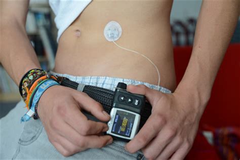 Glukose ist zwar eine lebenswichtige energiequelle für die zellen. Vorurteile über Diabetes auf dem Prüfstand | Gesundheit ...