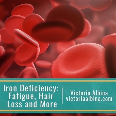 This simply means that adrenal fatigue causes disruption in hormone production, and this results in hormonal imbalance. Iron Deficiency: Fatigue, Hair Loss and More - Victoria Albina