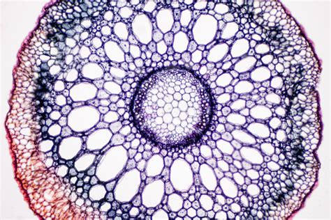 Check spelling or type a new query. Cross Sections Of The Plant Root Under Microscope View ...