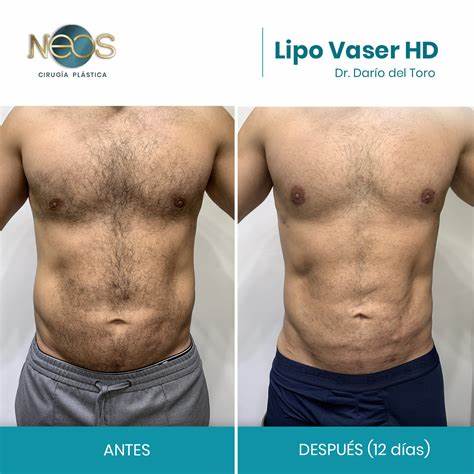 Lipo store отзывы жиросжигатели покупателей   Lipo store отзывы жиросжигатели покупателей