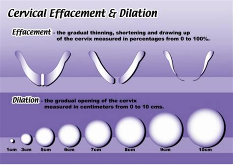 Your contractions will be more frequent, regular, and stronger. 8 Cm Dilated Cervix
