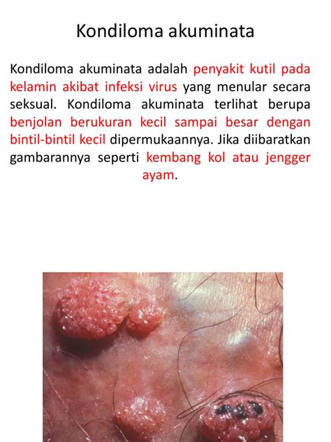 Tips Menghilangkan Kutil Kelamin Di Klinik Kesehatan