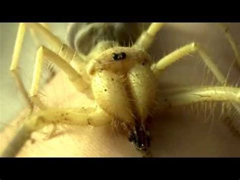 Although not poisonous, camel spider bite can be terribly painful leaving severely fierce looking wound at the bite area. Solifugae