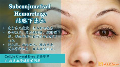 Researchers had recently discovered a cutting edge technology in the area of 'eye health and body wellness'. 【Cellglo Crystal Eyes水晶眼睛】各种眼睛问题的救星!!