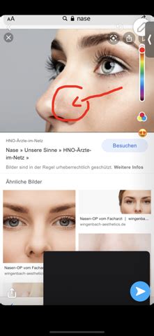 Wenn die nase innen verletzt als heilen, wird ein arzt nach sorgfältiger untersuchung des patienten manchmal, wenn eine wunde nase nach innen, kann es durch eine entzündung der blutgefäße. Wieso tut meine Nase weh? (Gesundheit und Medizin)