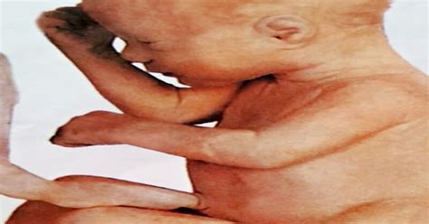 Namun tidak jarang ibu yang sedang hamil muda pun juga merasakan ingin sering buang air kecil. Perkembangan Janin Usia Kehamilan 26 Minggu - Klinikabar