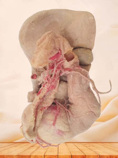 What are the effects of the pancreas? Liver stomach pancreas and duodenum plastinated specimen